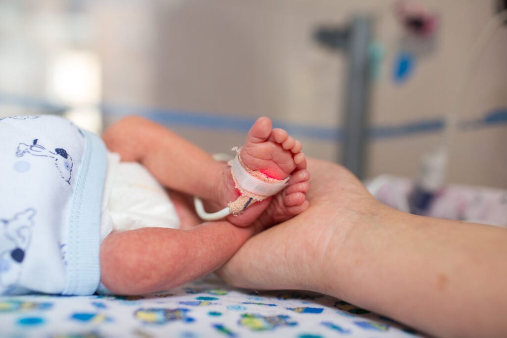 Ibu memegang kaki bayi prematur dengan oksimeter nadi neonatus selama skrining bayi baru lahir.