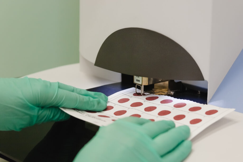 Gloved hands handling a dried blood spot (DBS) card being analyzed by laboratory equipment, showcasing a critical tool used in newborn screening