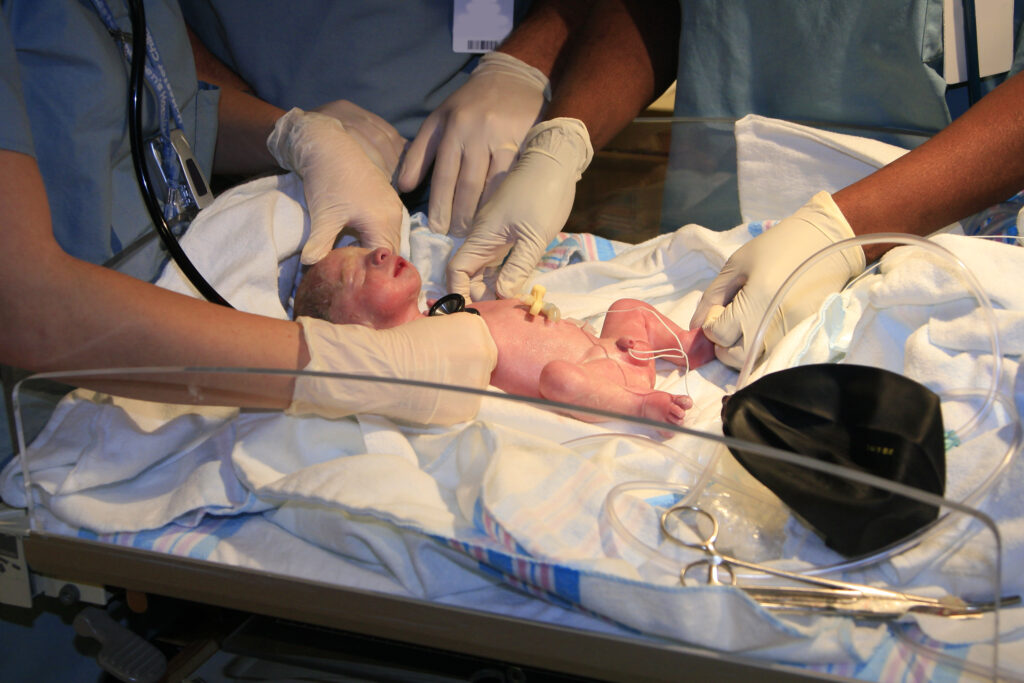 Medical professionals wearing gloves provide care to a newborn in a neonatal setting, with the baby lying on a hospital bassinet surrounded by medical equipment.