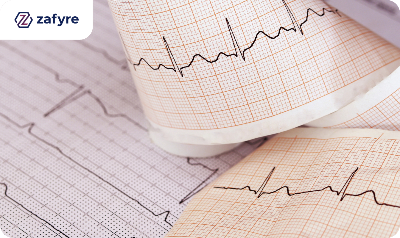 Pelatihan Interpretasi EKG: Kuasai Analisis dan Diagnosis di Bulan Kesehatan Jantung