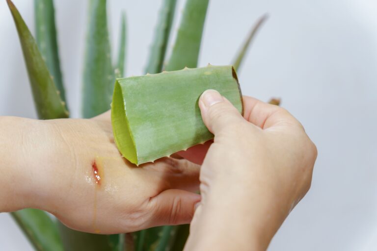 A person applies aloe vera gel to a small wound on their hand, illustrating traditional remedies and common wound management mistakes when not using sterile methods.