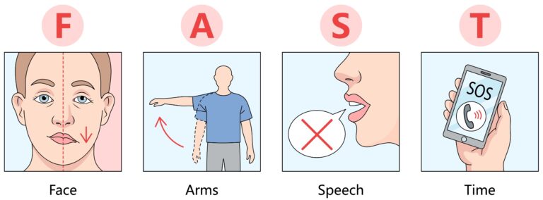 Infographic showing the FAST warning signs of stroke—Face drooping, Arm weakness, Speech difficulty, and Time to call emergency services—highlighting critical nursing assessment red flags for early stroke recognition and rapid response.